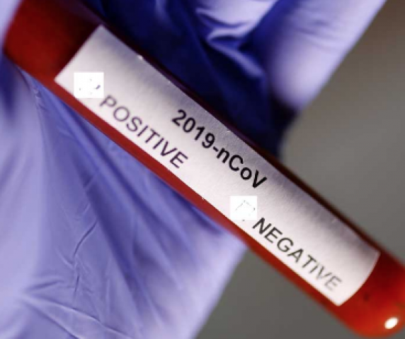 captura_de_ecra_2020_03_2_a_s_17_22_58